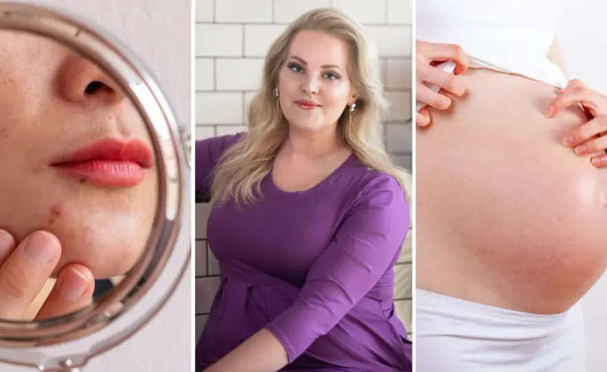 Finnar under graviditet - Trygg hudvård för dig och bebisen