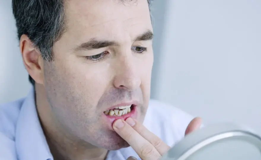 Ból dziąseł: Przyczyny, domowe sposoby i kiedy iść do dentysty