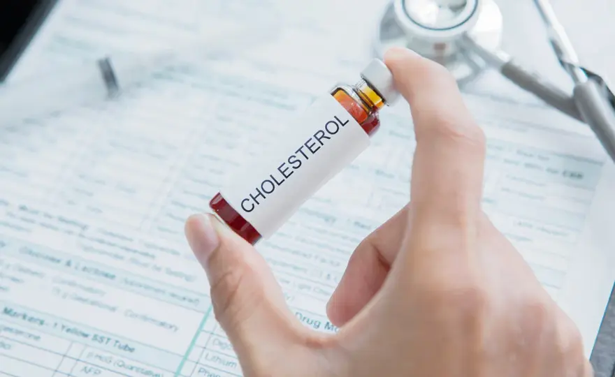 Tabletki na cholesterol do końca życia? - Kiedy można je odstawić?