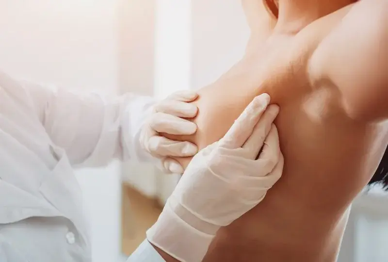 Jak zmniejszyć torbiele w piersiach: 8 skutecznych metod