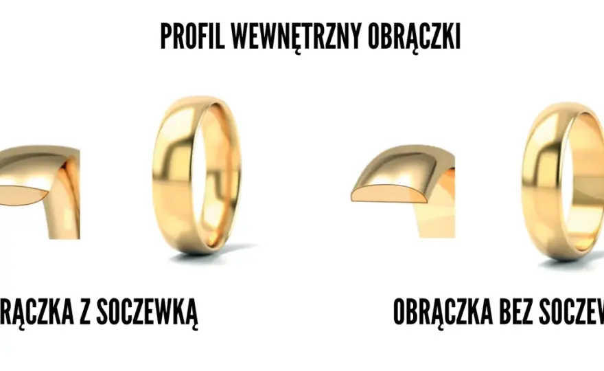 Obrączki z soczewką: co to znaczy i czy warto? Komfort na lata!