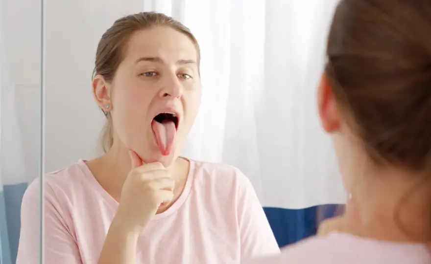 Lengua blanca y dolor de garganta: causas y señales de alarma