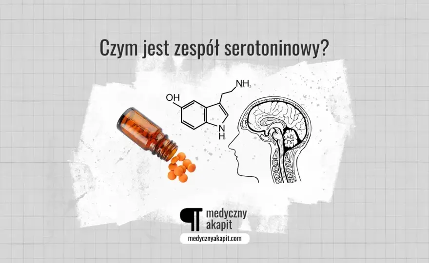 Zespół serotoninowy - objawy, leczenie i ryzyko. Sprawdź leki!