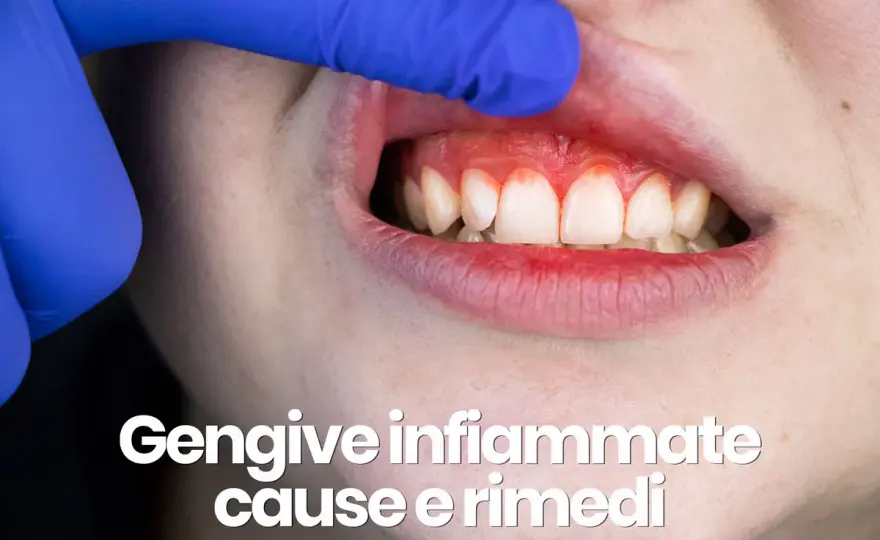 Dolore gengivale persistente: cause, rimedi e quando agire