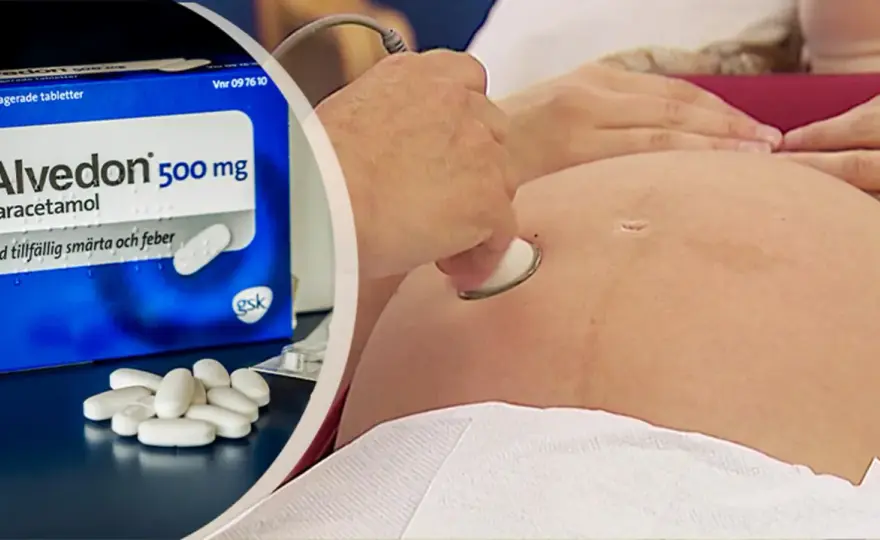 Paracetamol under graviditet - så använder du det säkert