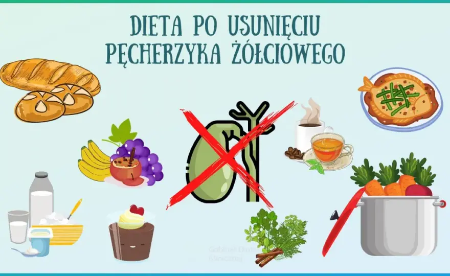Dieta po usunięciu pęcherzyka żółciowego - Jak jeść bez bólu?