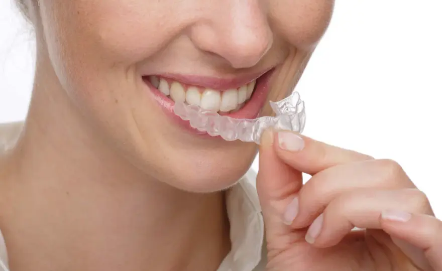 ¿Invisalign duele? Molestias normales y cuándo preocuparse