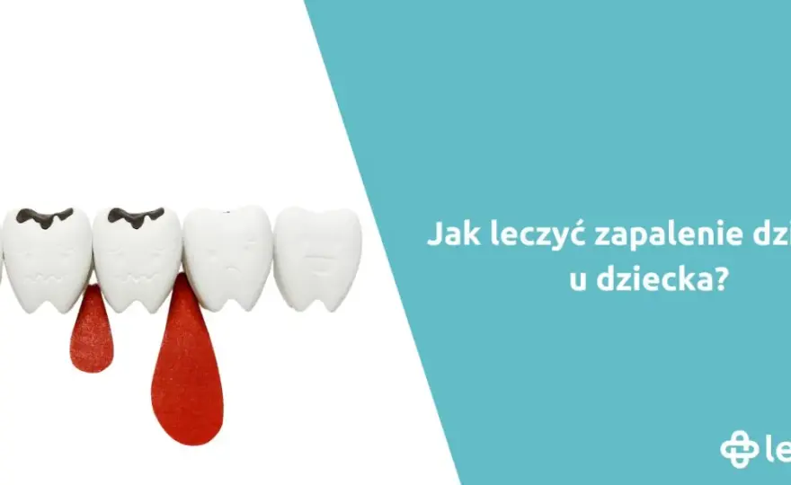 Zapalenie dziąseł u dziecka: Ile trwa i jak szybko ulżyć maluchowi?