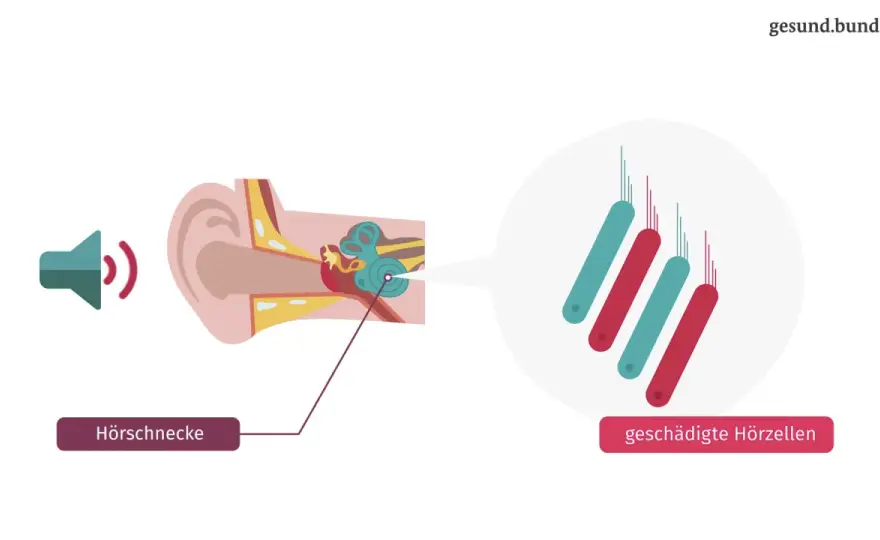 Tinnitus nach Infekt oder Allergie - Wann du handeln musst