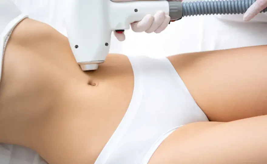 Depilacja laserowa bikini: harmonogram i sekrety trwałej gładkości