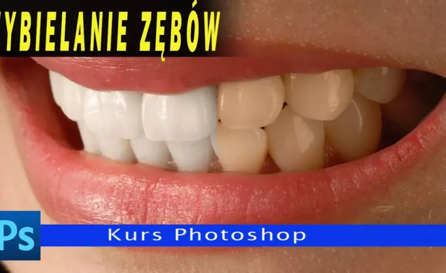 Wybielanie zębów na zdjęciu - Naturalny retusz krok po kroku