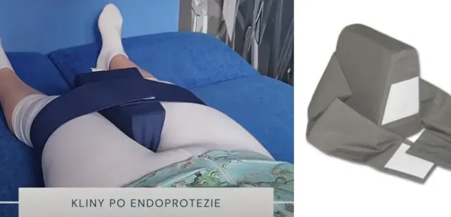 Czy po endoprotezie biodra przysługuje renta? Sprawdź warunki i pomoc