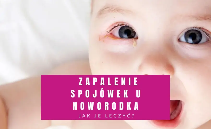 Czerwone powieki u noworodka - Kiedy do lekarza?