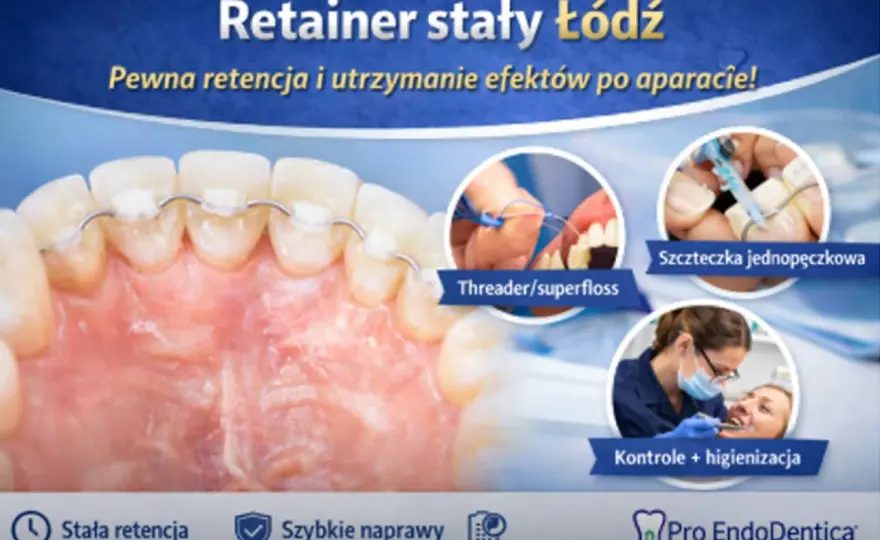 Stały retainer po aparacie - co musisz wiedzieć, by utrzymać efekt?