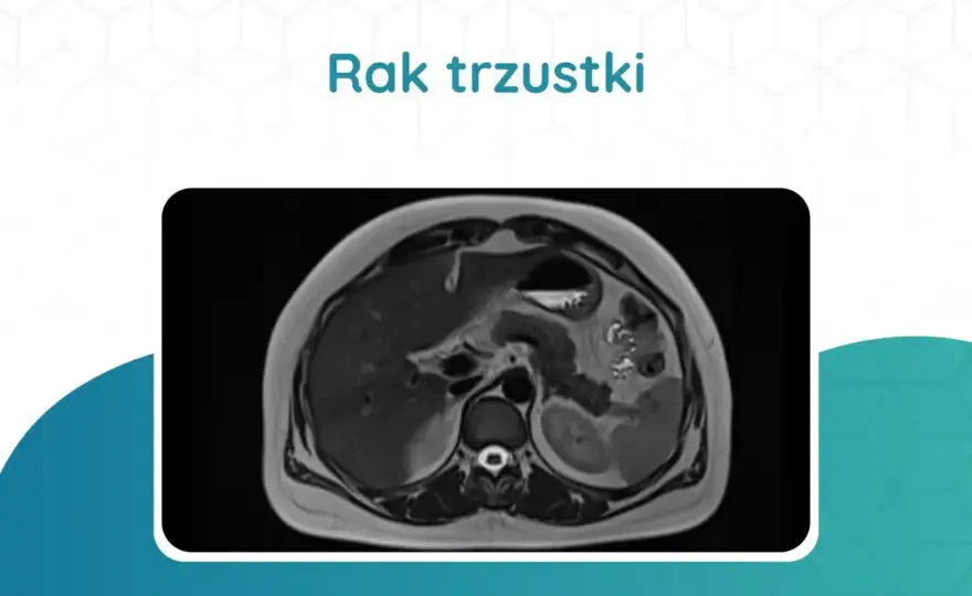 Badania trzustki - Jakie wybrać i jak interpretować?