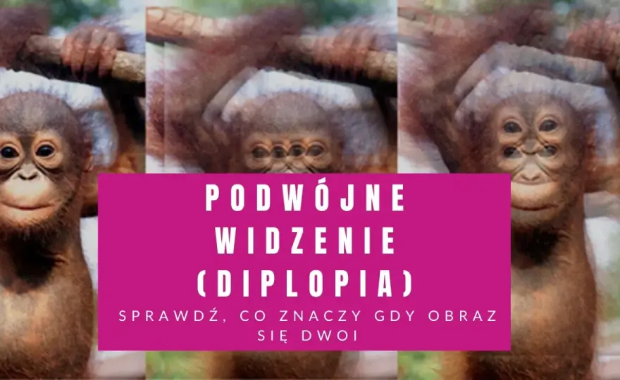 Podwójne widzenie - Kiedy to groźny objaw?