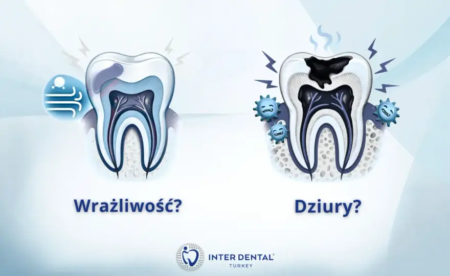 Ból zęba przy nagryzaniu - Kiedy to alarm, a kiedy nadwrażliwość?