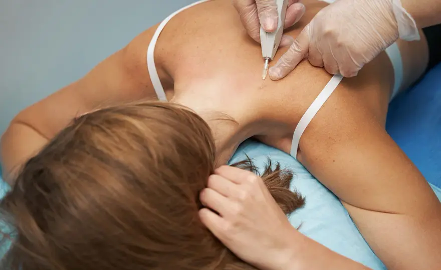 Carboxiterapia Corporal - ¿Funciona? Precios y Claves antes de Elegir