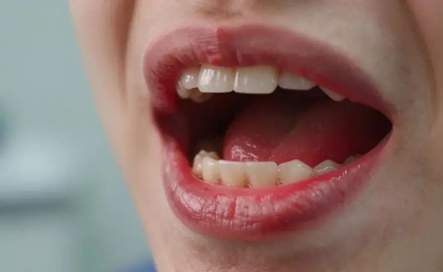 Podrażnione dziąsła? Sprawdzone sposoby i kiedy iść do dentysty