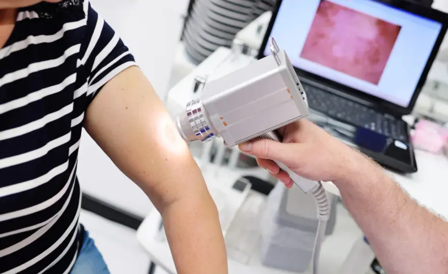 Dermatoskopia - czy Twoje znamiona są bezpieczne? Sprawdź!