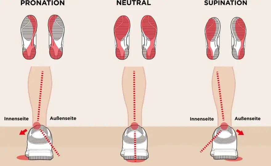 Pronation beim Laufen - Normal oder Problem? Der Läufer-Guide