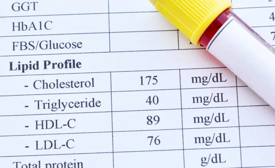 Lipidogram - co to i jak czytać? Wyniki LDL, HDL, triglicerydy