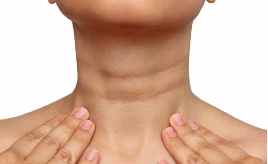 Acantosis nigricans - causas y tratamientos seguros para la piel