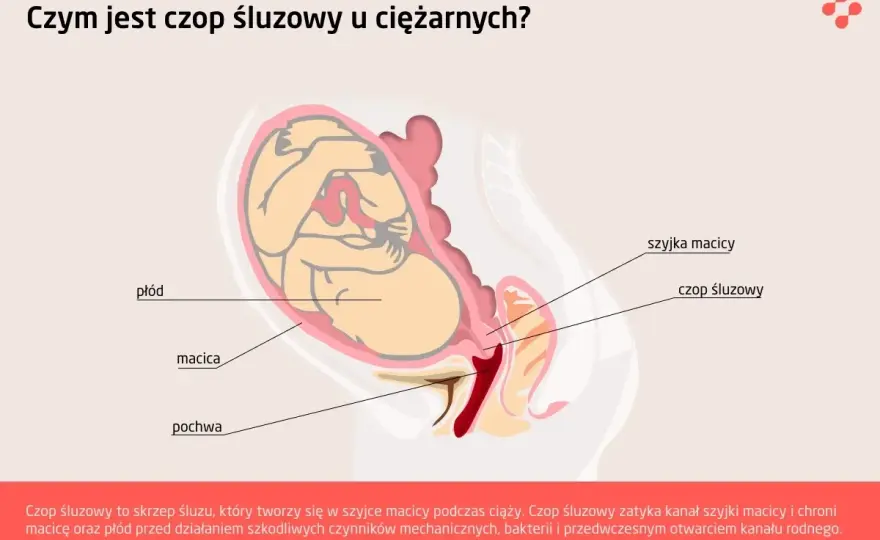 Czop śluzowy - sygnał porodu czy powód do niepokoju?