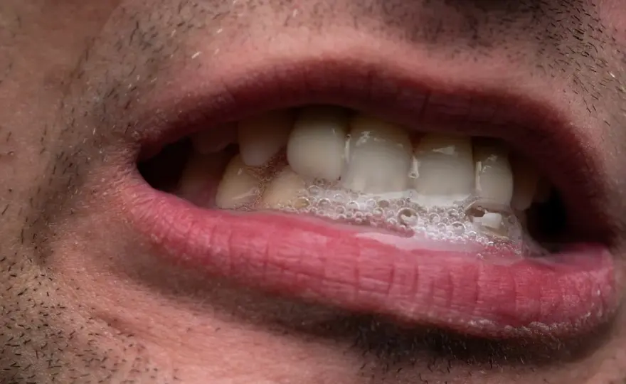 Ansia e saliva - quando sembra troppa e cosa fare