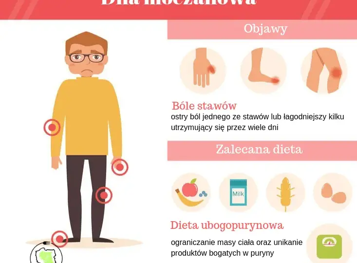 Dna moczanowa: jakie badania? Od objawów do pewnej diagnozy