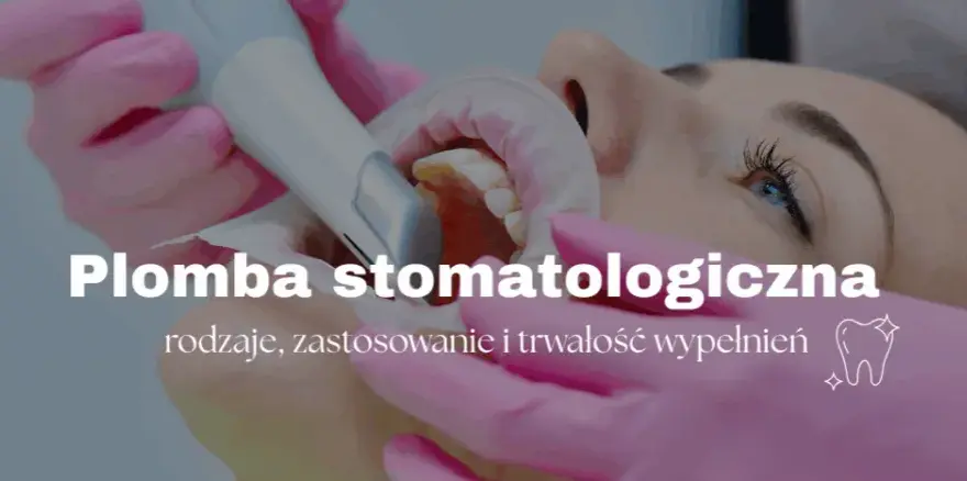 Plombowanie zęba: Ile to potrwa? Czas, etapy i komfort wizyty