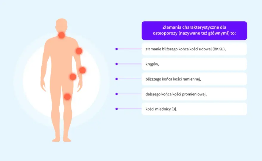 Objawy bólowe osteoporozy - kiedy to już może być złamanie?