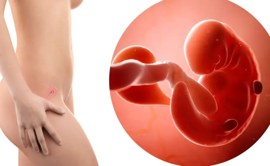 Pancia gonfia a 6 settimane - Cosa significa davvero?