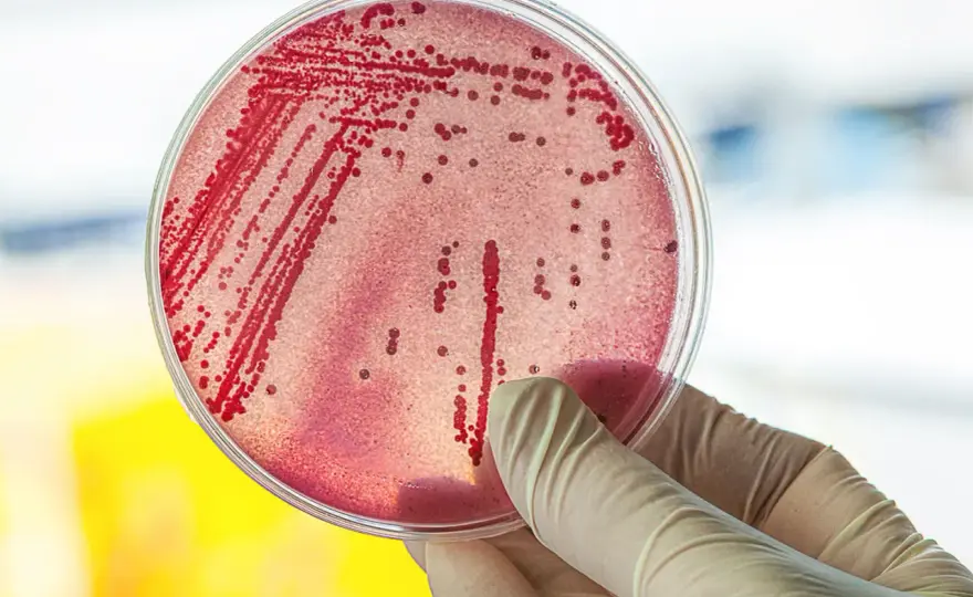 Symptome E. coli: Erkennen Sie die gefährlichen Anzeichen einer Infektion