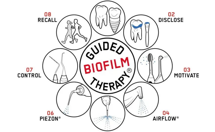 Biofilm dentale - La guida per una bocca sana ogni giorno