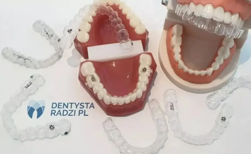 Headgear ortodontyczny - czy warto? Koszt, działanie, efekty