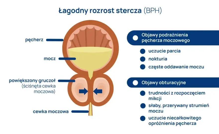 Prostata - budowa, położenie i funkcje, które warto znać