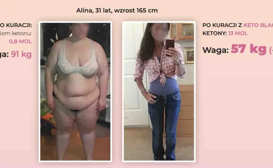 Dieta keto - zasady, efekty, pułapki. Czy to dla Ciebie?