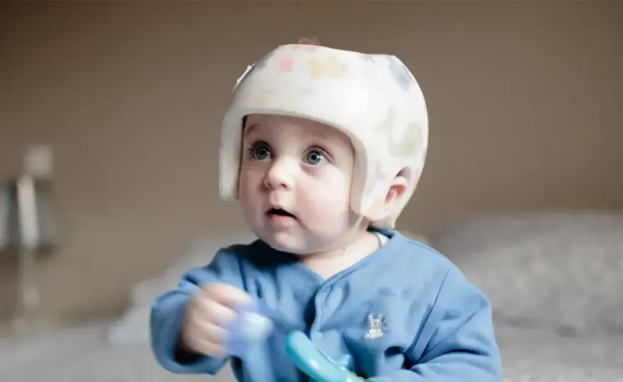 Kask korekcyjny u niemowlęcia - kiedy ma sens i ile kosztuje?