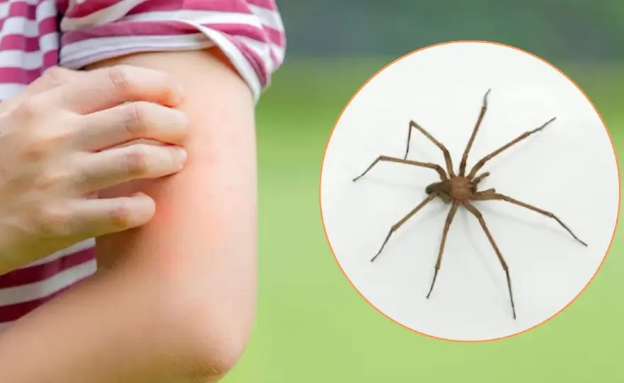 Picadura de Araña - Qué Hacer y Cuándo Preocuparse