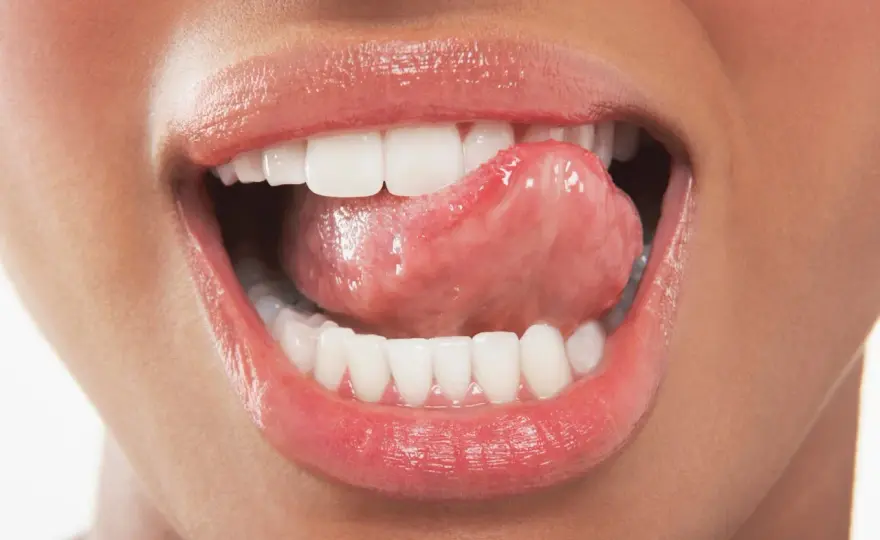 Denti ruvidi - Cause, rimedi e quando serve il dentista