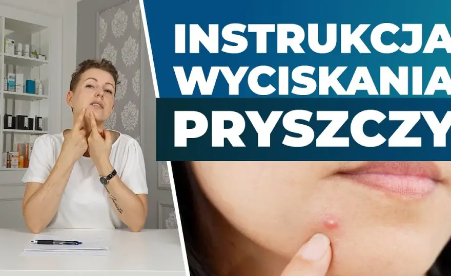 Pryszcze: Wyciskać czy nie? Poradnik eksperta i "trójkąt śmierci"