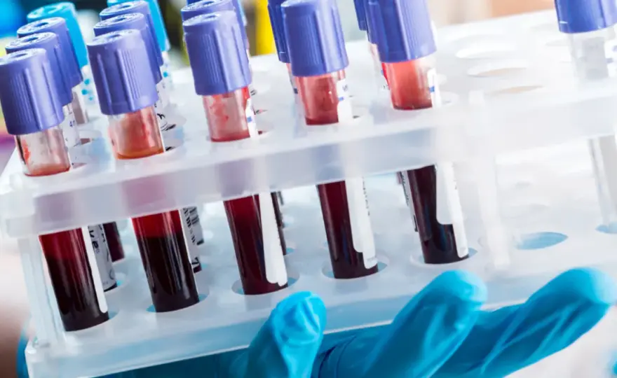 Diagnosta laboratoryjny i inni: Kto odpowiada za Twoje wyniki?