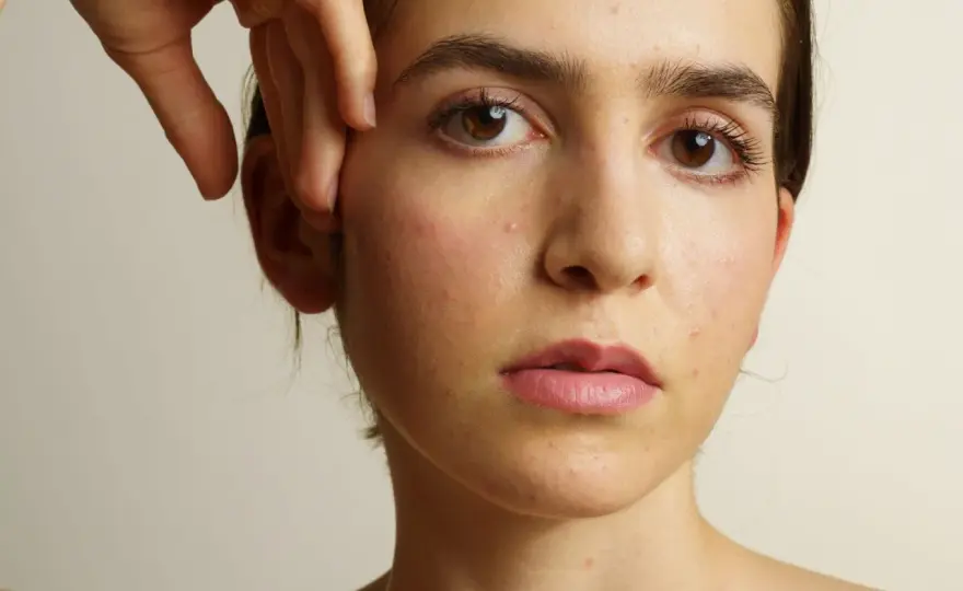Acné et ménopause - causes et solutions pour une peau apaisée