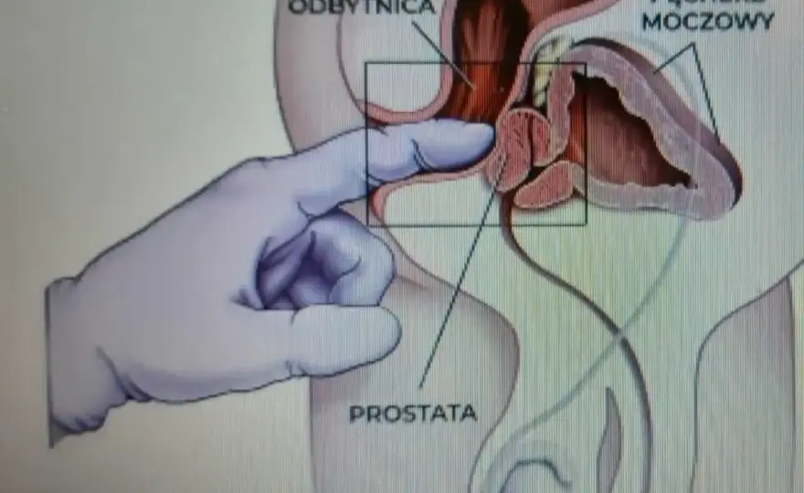 Masaż prostaty - jak zacząć bezpiecznie i bez pośpiechu