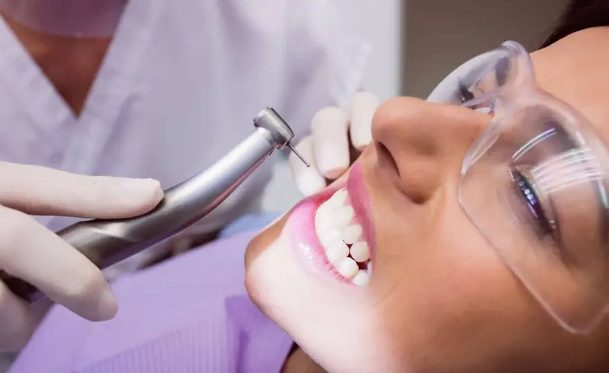 Togliere il tartaro dai denti - Guida completa e sicura