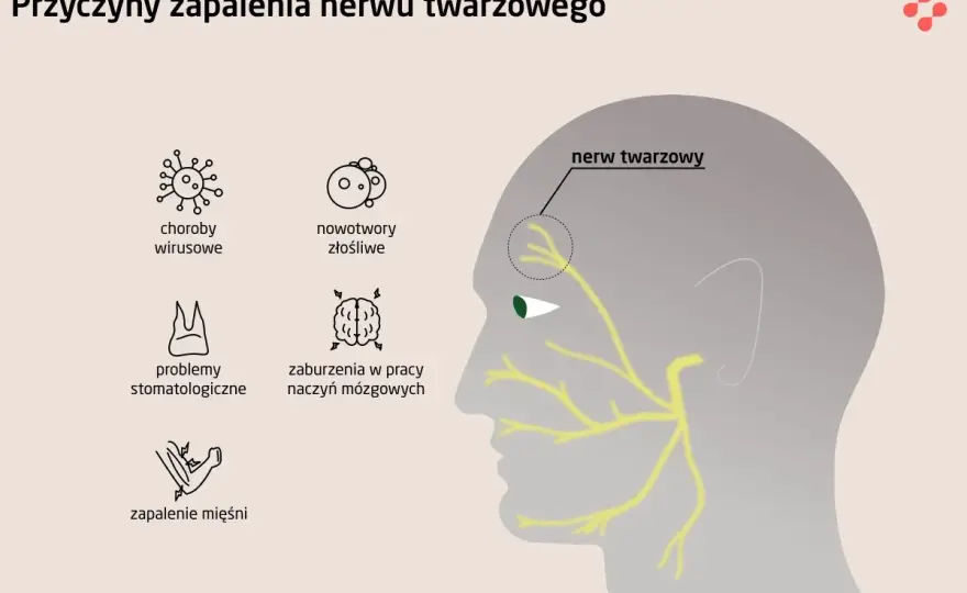 Nerw twarzowy - objawy, przyczyny i leczenie. Kiedy do lekarza?