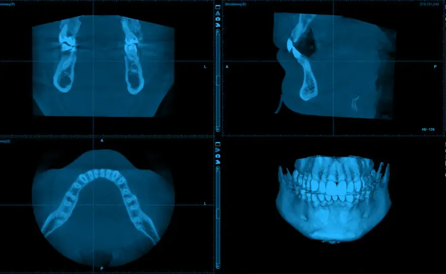 CBCT w stomatologii - Kiedy warto, a kiedy to błąd?
