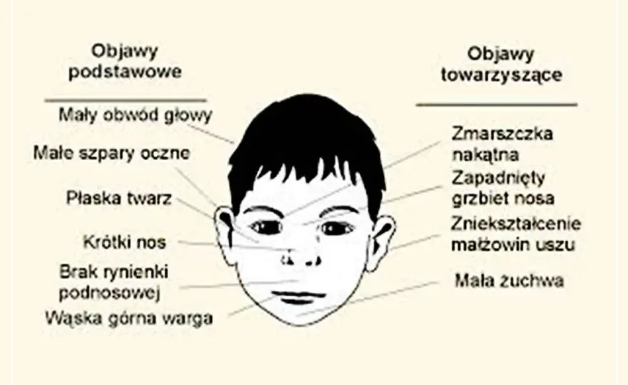 FAS u gwiazd - jak odróżnić diagnozę od plotki?