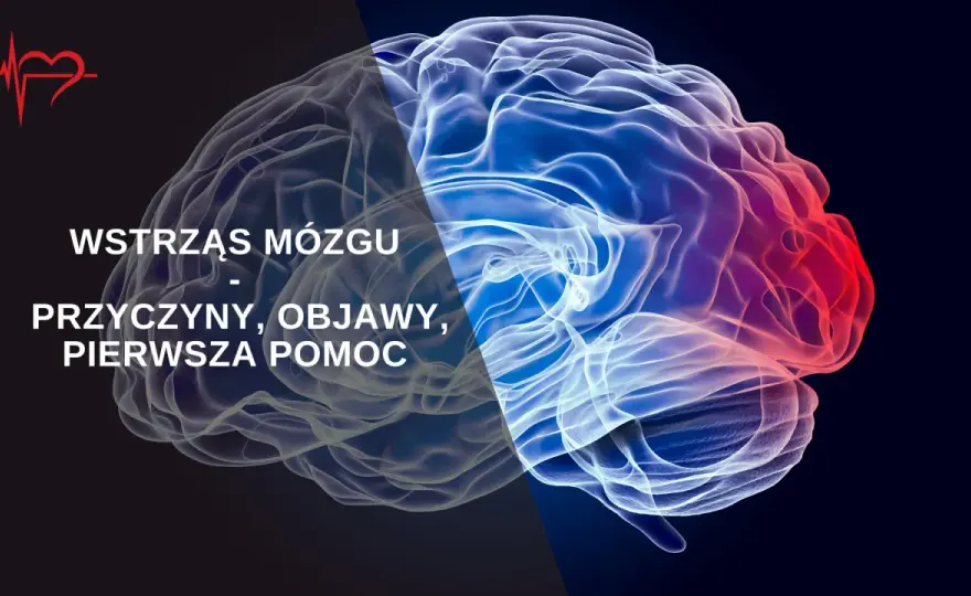 Wstrząśnienie mózgu objawy: co musisz wiedzieć o skutkach urazu głowy